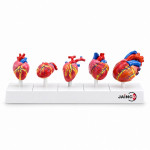 Comparison of the Heart in Vertebrates